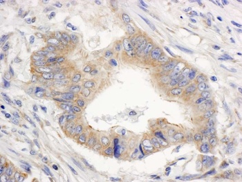 Rabbit SPTAN1/Alpha II-spectrin Antibody