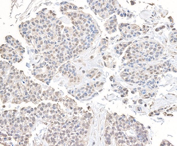 Rabbit CHD8 Antibody