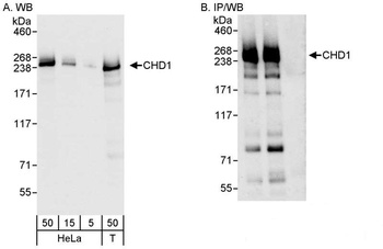 Rabbit CHD1 Antibody