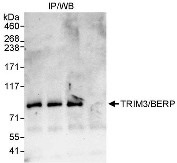 Rabbit TRIM3/BERP Antibody