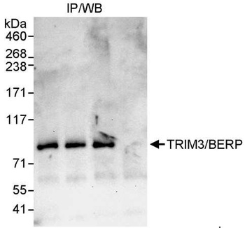 Rabbit TRIM3/BERP Antibody