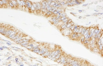 Rabbit TRIM3/BERP Antibody