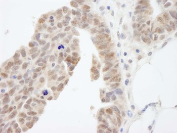 Rabbit ABI1 Antibody
