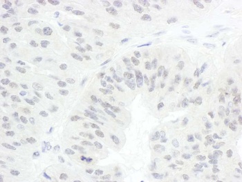 Rabbit CDC20 Antibody