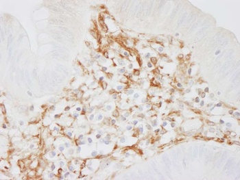 Rabbit Filamin A Antibody