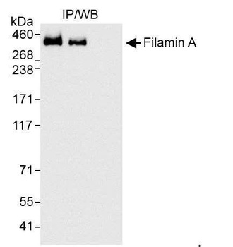 Rabbit Filamin A Antibody