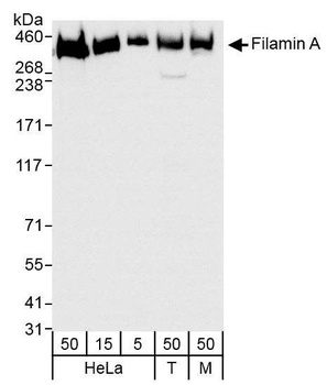 Rabbit Filamin A Antibody
