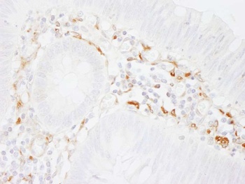 Rabbit Filamin A Antibody
