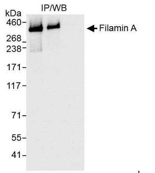 Rabbit Filamin A Antibody