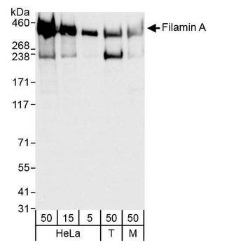 Rabbit Filamin A Antibody
