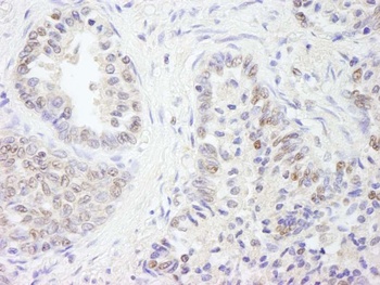 Rabbit UBE1 Antibody
