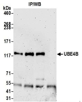 Rabbit UBE4B Antibody