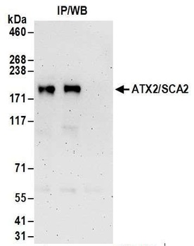 Rabbit ATX2/SCA2 Antibody