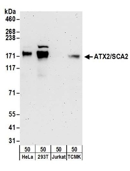 Rabbit ATX2/SCA2 Antibody