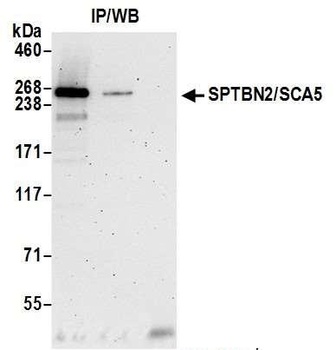 Rabbit SPTBN2/SCA5 Antibody
