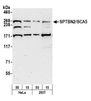 Rabbit SPTBN2/SCA5 Antibody
