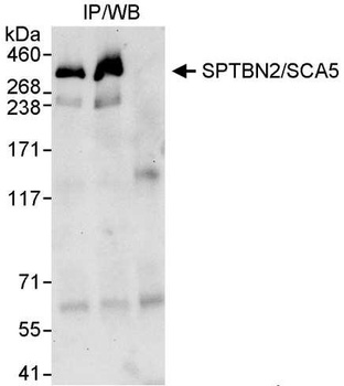 Rabbit SPTBN2/SCA5 Antibody