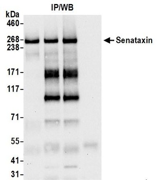 Rabbit Senataxin Antibody