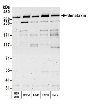 Rabbit Senataxin Antibody