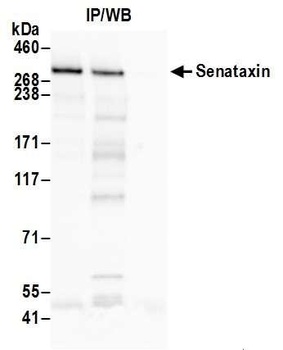 Rabbit Senataxin Antibody