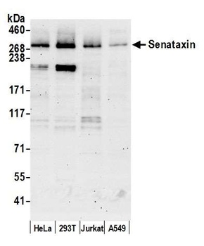 Rabbit Senataxin Antibody