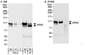 Rabbit XRN2 Antibody