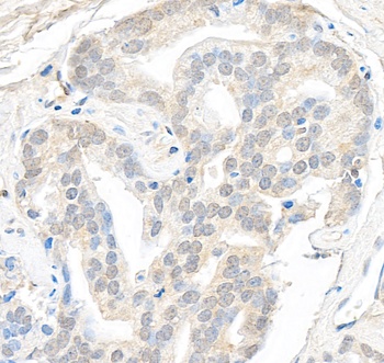 Rabbit anti-SMARCB1/SNF5 Antibody