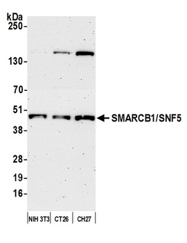 Rabbit anti-SMARCB1/SNF5 Antibody