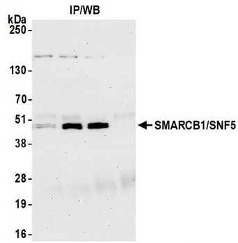 Rabbit anti-SMARCB1/SNF5 Antibody