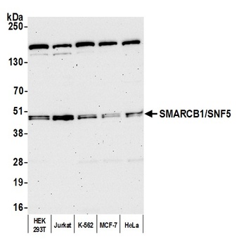Rabbit anti-SMARCB1/SNF5 Antibody