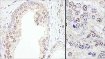 Rabbit TRIM33/TIF1gamma Antibody