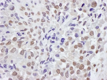 Rabbit TRIM33/TIF1gamma Antibody