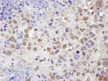 Rabbit TRIM33/TIF1gamma Antibody