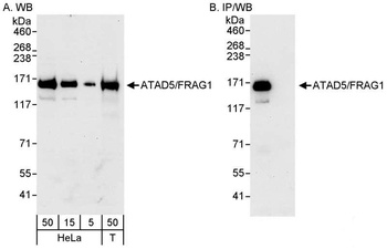 Rabbit ATAD5/FRAG1 Antibody