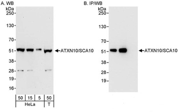 Rabbit ATXN10/SCA10 Antibody