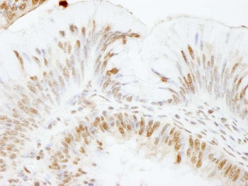 Rabbit USP47 Antibody