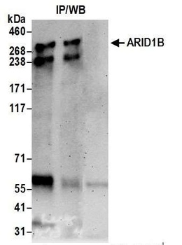 Rabbit ARID1B Antibody