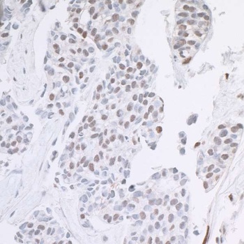Rabbit ARID1B Antibody