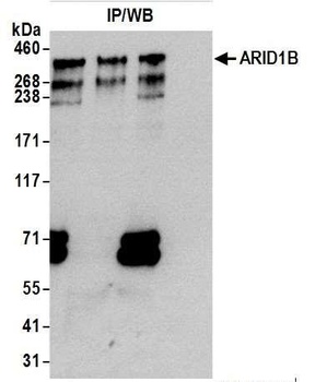 Rabbit ARID1B Antibody