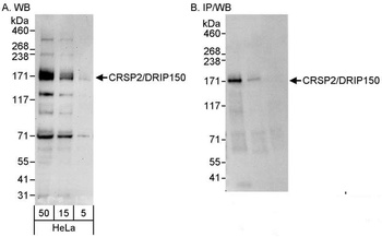 Rabbit anti-CRSP2/DRIP150 Antibody