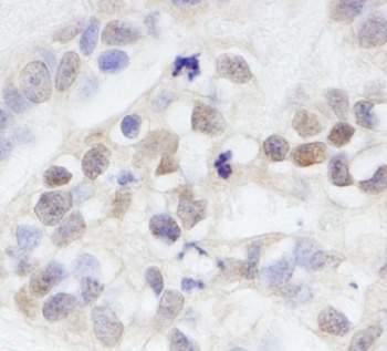 Rabbit MAGED2 Antibody