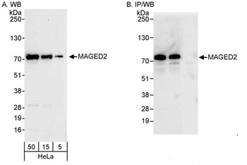 Rabbit MAGED2 Antibody