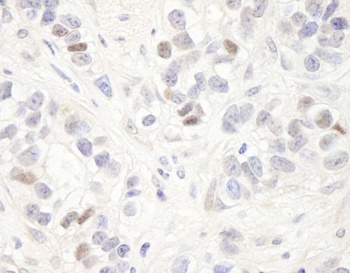 Rabbit MAGED2 Antibody