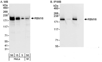 Rabbit RBM16 Antibody