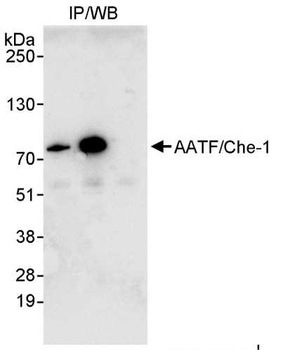 Rabbit AATF/Che-1 Antibody