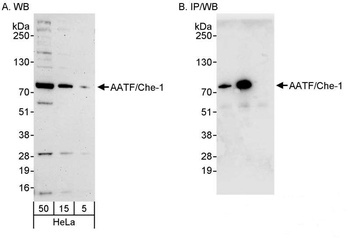 Rabbit AATF/Che-1 Antibody
