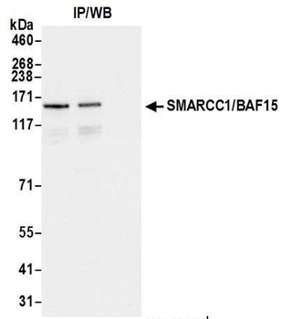 Rabbit SMARCC1/BAF155 Antibody