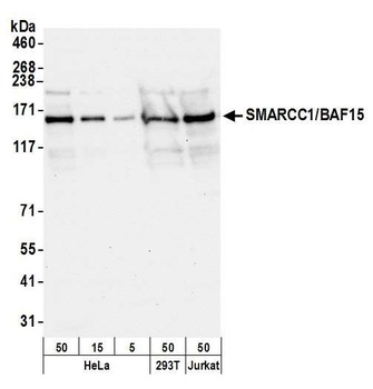 Rabbit SMARCC1/BAF155 Antibody