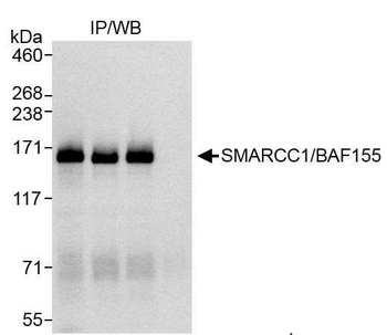 Rabbit SMARCC1/BAF155 Antibody
