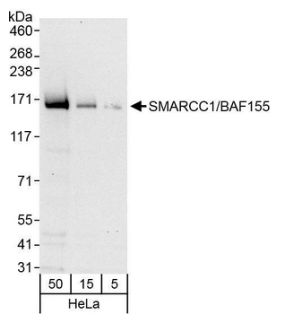Rabbit SMARCC1/BAF155 Antibody